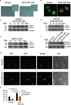 Blockade of Uttroside B-Induced Autophagic Pro-Survival Signals Augments Its Chemotherapeutic Efficacy Against Hepatocellular Carcinoma